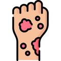 Prevents skin conditions